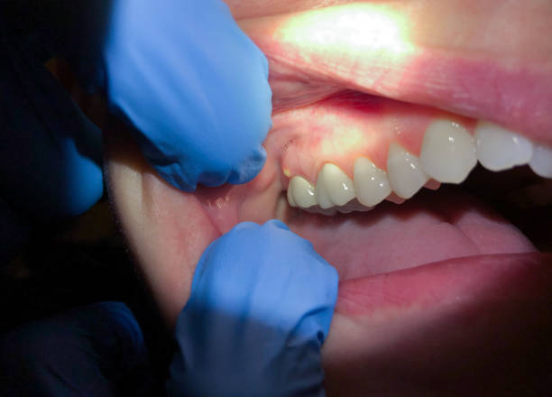 Best Emergency TMJ Treatment in Parlier, CA