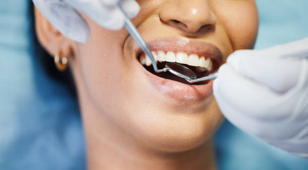 Best Cosmetic Emergency Dentistry in Parlier, CA